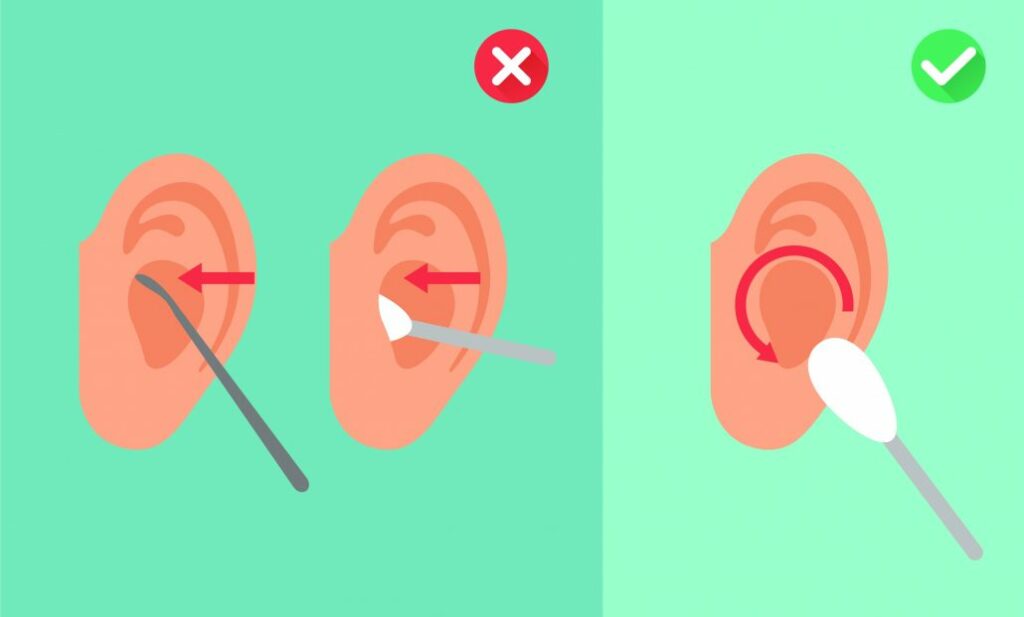 Comment nettoyer ses oreilles ? - Votre expert auditif - Meilleur ...