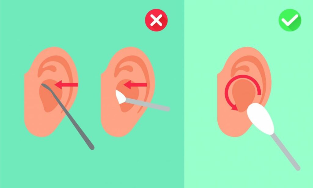 Comment déboucher une oreille en cas de bouchon de cérumen ?